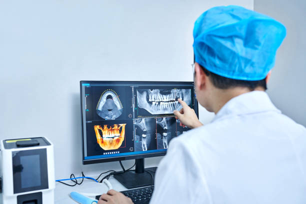 Best Emergency Tooth Extraction in Livingston, TX